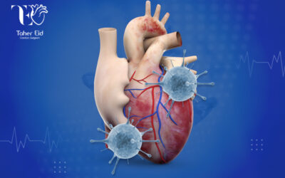 استئصال أورام القلب