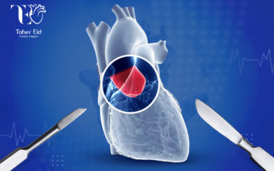 جراحة إصلاح واستبدال الصمام الأورطي