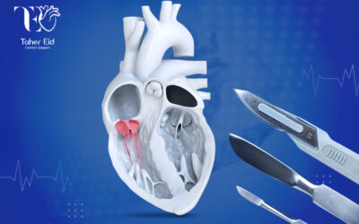جراحة إصلاح واستبدال الصمام ثلاثي الشرفات