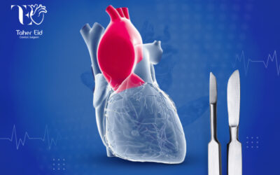 جراحات تمدد وانسلاخ الشريان الأورطي