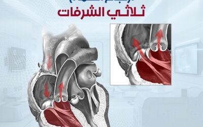 ارتجاع الصمام ثلاثي الشرفات