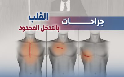 الآن جراحة القلب بالتدخل المحدود: ثورة في عالم جراحة القلب