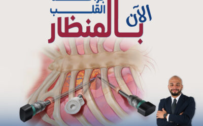 الآن جراحة القلب بالمنظار (التدخل المحدود)