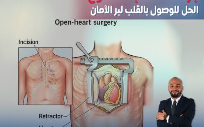 جراحات القلب المفتوح.. الحل للوصول بالقلب لبر الآمان