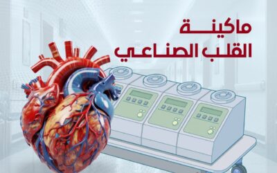 ماكينة القلب الصناعي