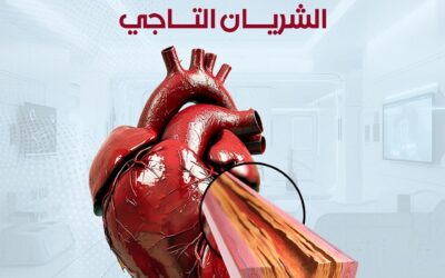 مرض الشريان التاجي